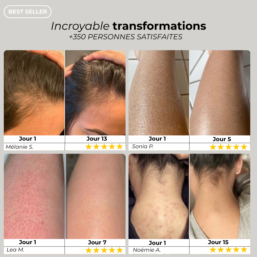 Pomme de douche filtrante – Offrez à votre peau et cheveux une protection quotidienne